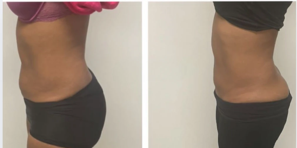 photo - Beauty Trenzz