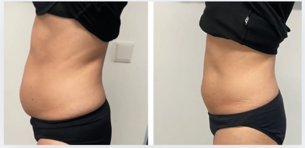 photo - Beauty Trenzz