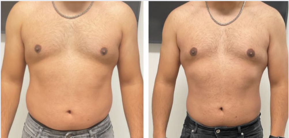 photo - Beauty Trenzz