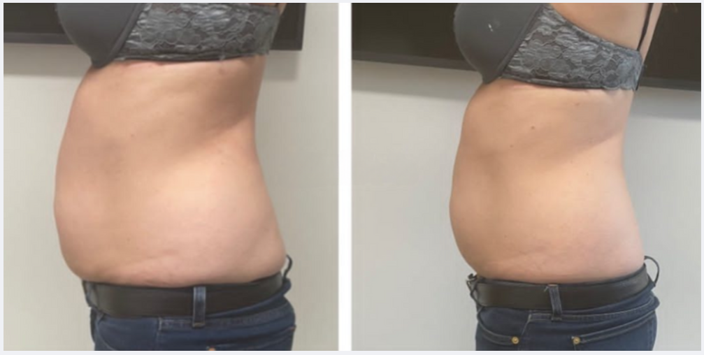 photo - Beauty Trenzz