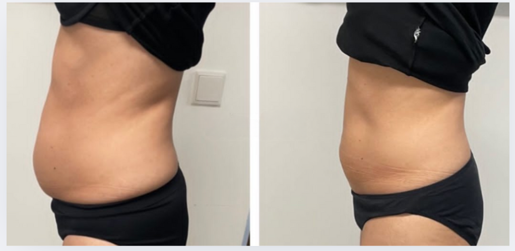 photo - Beauty Trenzz